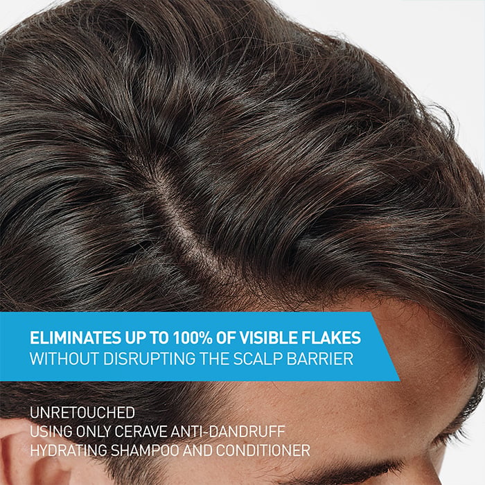 Anti-Dandruff Hydrating Shampoo